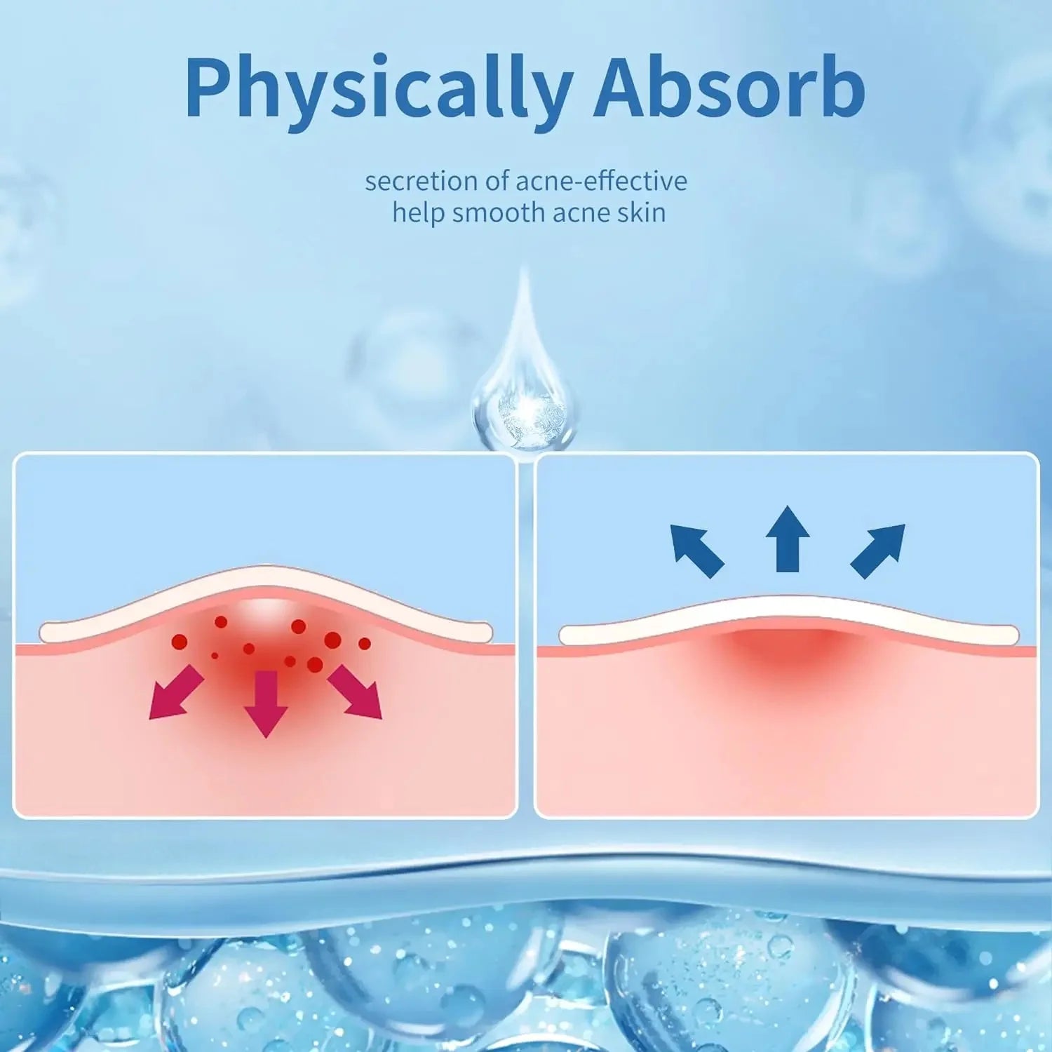 180/360PCS Invisible Acne Veneer Lump Sticker Reduce Acne Cleansing Pores Oil Removal Repair and Smooth Skin Facial Products Var--ANDROMEDA QUINNS | AURELLE'S-ANDROMEDA QUINNS | AURELLE'S